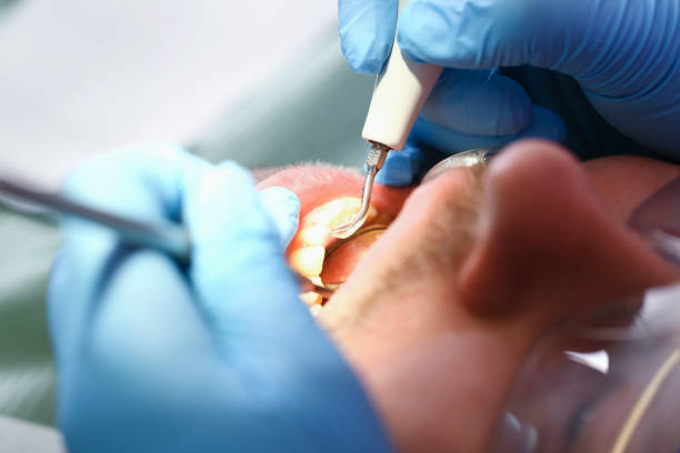 Best Emergency Dental Extractions in Barboursville, WV
