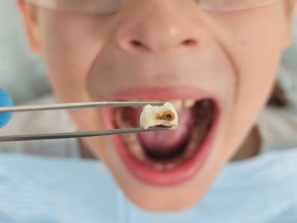 Best Orthodontic Emergency Dentist in Barboursville, WV